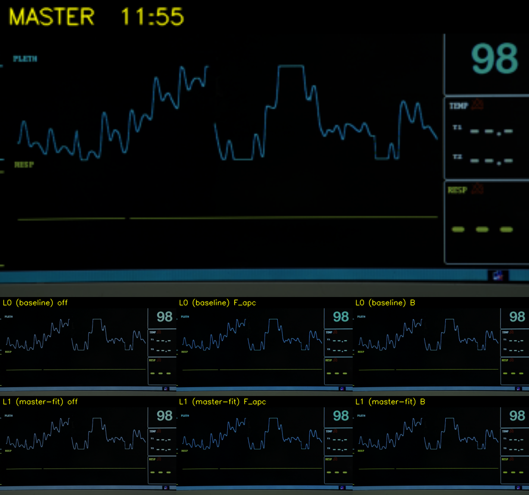 montage at t=715s (medical monitor)